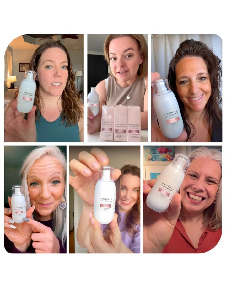 H-REGROW 2.0 – Visible Fuller Hair